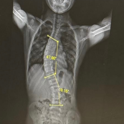 xray